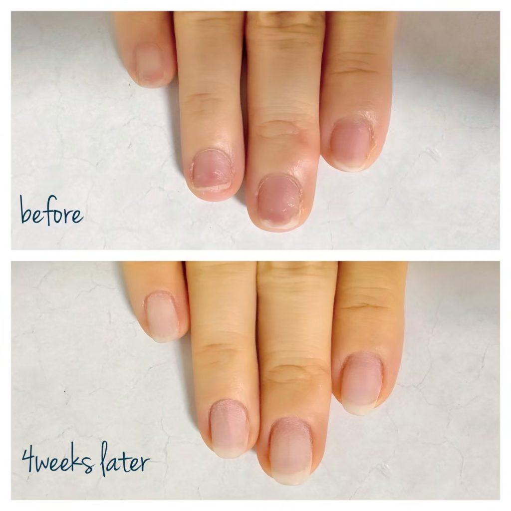 自爪育成 ビフォー